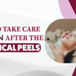 Tips to Take Care of Skin After the Chemical Peels