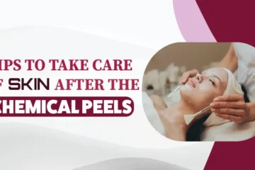 Tips to Take Care of Skin After the Chemical Peels