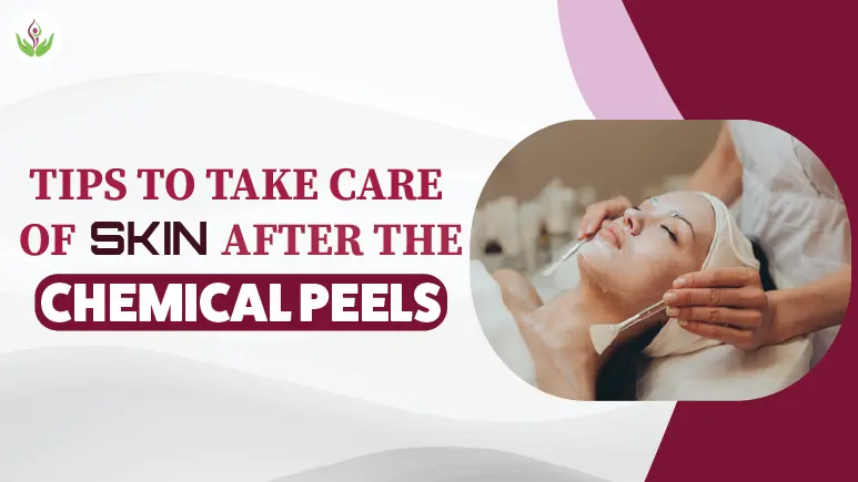 Tips to Take Care of Skin After the Chemical Peels
