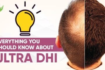 Ultra DHI Hair Transplant – A Natural Remedy for Hair Fall