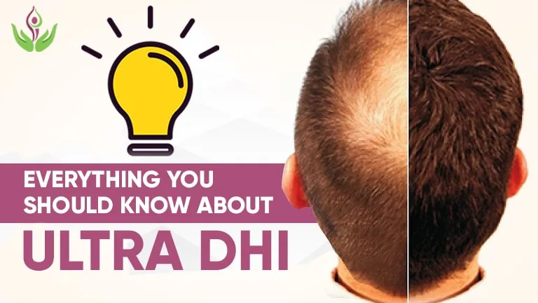 Ultra DHI Hair Transplant – A Natural Remedy for Hair Fall