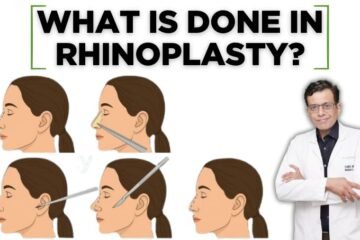 What Is Done in Rhinoplasty? A Complete Guide