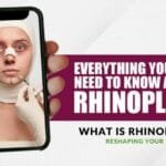 What is Rhinoplasty? – Reshaping Your Nose