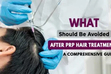 What Should Be Avoided After PRP Hair Treatment