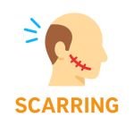 Scarring