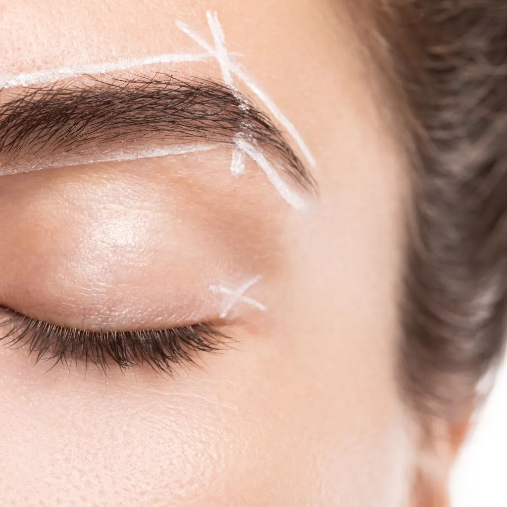 Eyebrow lift