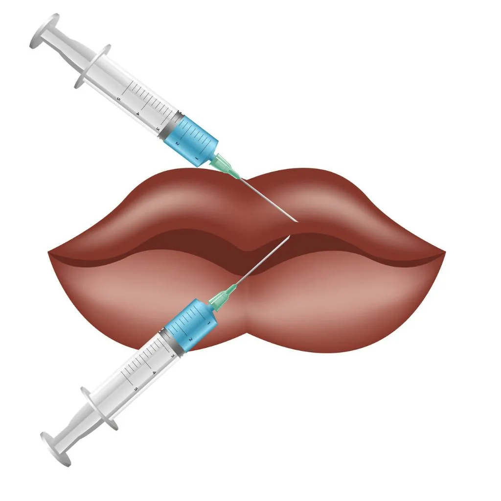 Fat Grafting for (Natural Lip Volume) lip augmentation in Delhi