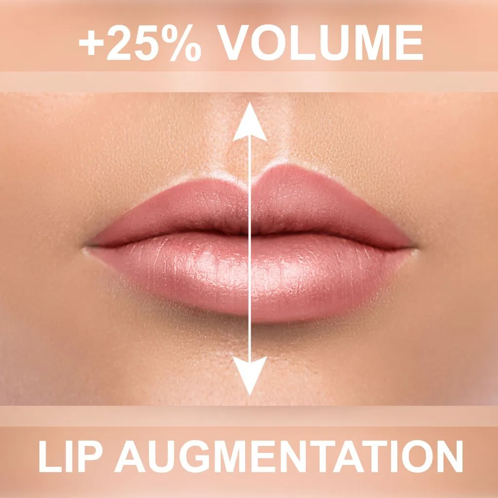 lip augmentation cosmetic treatment