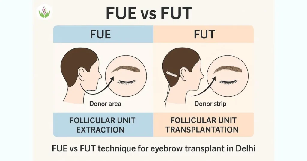 FUE vs FUT eyebrow transplant technique comparison – donor area and graft method illustration at Care Well Medical Centre, Delhi