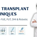 Comparison of hair transplant techniques: FUE, FUT, DHI, and Robotic methods explained by Dr. Sandeep Bhasin