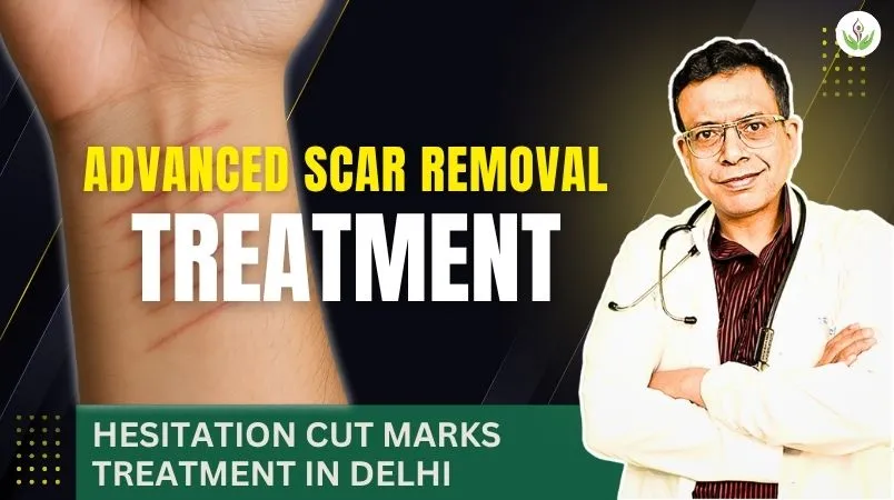 Hesitation cut marks treatment and scar removal in Delhi – Dr. Sandeep Bhasin