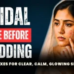 Bridal acne before wedding treatment by Dr. Sandeep Bhasin at Care Well Medical Centre Delhi