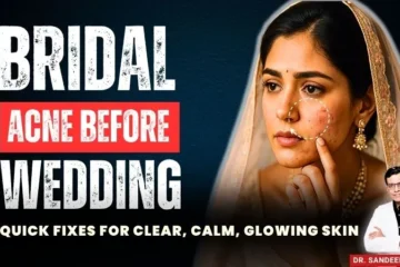 Bridal acne before wedding treatment by Dr. Sandeep Bhasin at Care Well Medical Centre Delhi