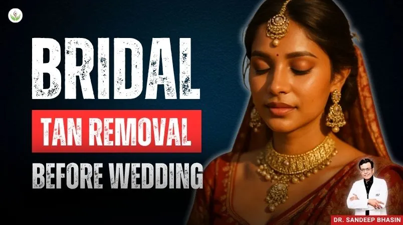 Bridal tan removal before wedding – Indian bride