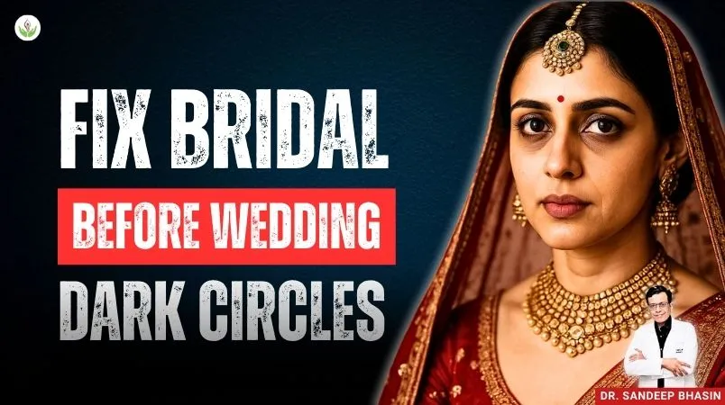 Bride with bright under eyes after dark circles treatment before wedding