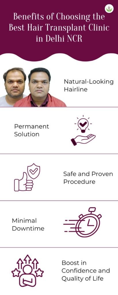 Benefits of Choosing the Best Hair Transplant Clinic in Delhi NCR