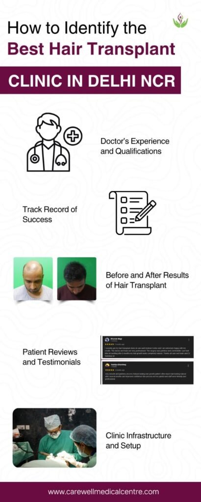 How to Identify the Best Hair Transplant Clinic in Delhi NCR