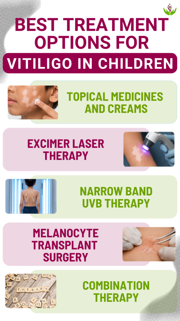 Best Treatment Options for Vitiligo in Children