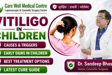Vitiligo in Children: Causes, Symptoms, Treatment & Cure Guide