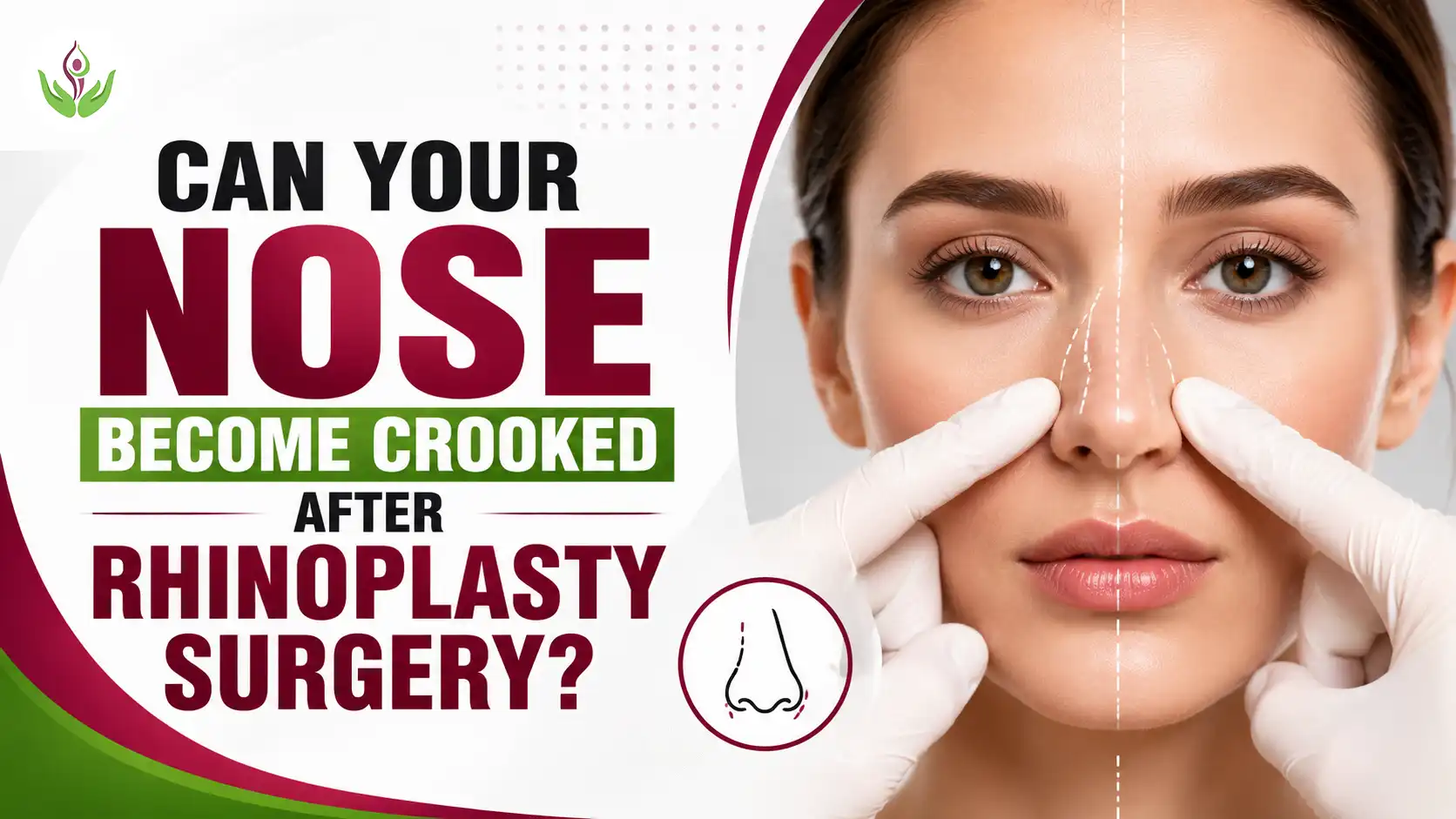 Can Your Nose Become Crooked After Rhinoplasty Surgery