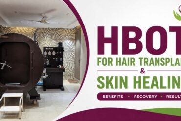 HBOT for Hair Transplant and Skin Healing